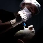 استخدام تکنسین کاشت مو باسابقه در خیابان مخابرات خرم آباد