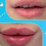 استخدام پزشک عمومی یا متخصص پوست و مو به عنوان مسئول فنی جهت کلینیک در استادمعین تهران