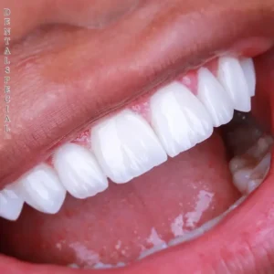 نیازمند منشی، کالسنتر و ادمین پیج جهت کلینیک دندانپزشکی هیوا در بنی هاشم تهران