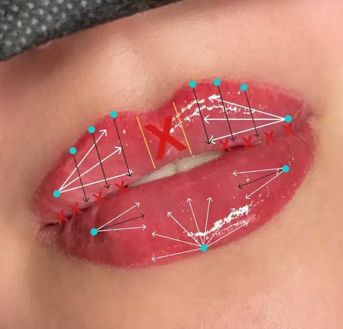 استخدام پزشک عمومی مسط به تزریقات زیبایی جهت مطب در شهرآرا تهران