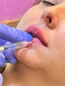 استخدام منشی خانم جهت مطب آشنا به تزریقات و اینستاگرام در شهرک پاسداران تهران