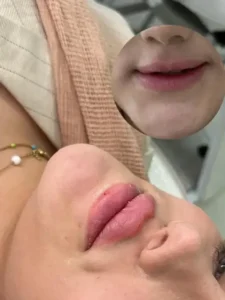 دعوت به همکاری از پزشک جهت کلینیک زیبایی در کیانپارس اهواز