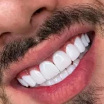 استخدام منشی و دستیار خانم جهت کلینیک دندانپزشکی در اندیشه تهران
