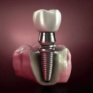 استخدام مسئول پذیرش جهت کلینیک دندانپزشکی در زرگنده تهران