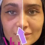 استخدام دستیار پزشک زیبایی در قم