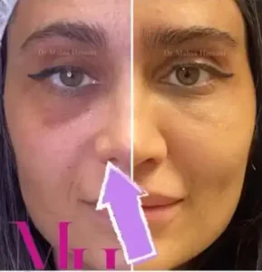 استخدام دستیار پزشک زیبایی در قم