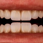 استخدام دستیار و منشی جهت کلینیک دندانپزشکی در هشتگرد