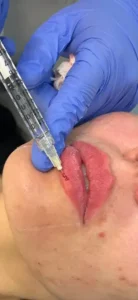 استخدام پزشک عمومی دارای پروانه جهت انجام امور زیبایی در بکایی قم