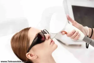 استخدام اپراتور لیزر خانم جهت کلینیک زیبایی در لاهیجان