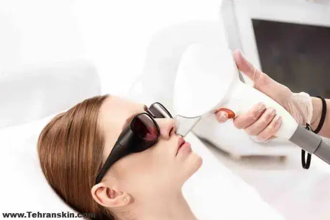 استخدام اپراتور لیزر خانم جهت کلینیک زیبایی در لاهیجان