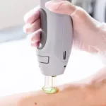 استخدام اپراتور لیزر خانم جهت کلینیک زیبایی در ارومیه