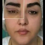دعوت به همکاری از پزشک زیبایی مسلط به جراحی های سرپایی دارای پروانه تهران