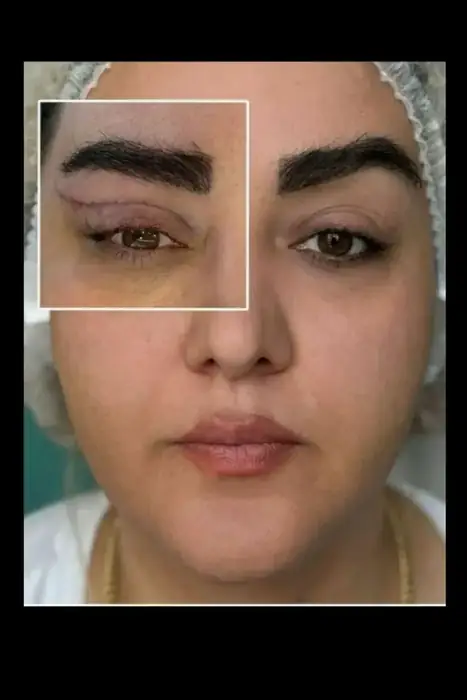 دعوت به همکاری از پزشک زیبایی مسلط به جراحی های سرپایی دارای پروانه تهران