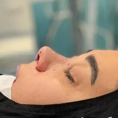 نیازمند منشی جهت مطب جراحی بینی در ونک تهران
