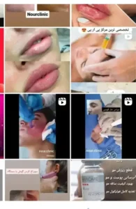 استخدام منشی جهت کلینیک زیبایی در سیرجان استان کرمان