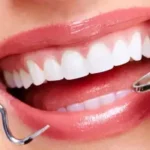 اجاره مطب 70متری دندانپزشکی مجهز در بلوار ولیعصر تبریز