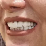 استخدام دستیار دندانپزشک جهت مطب در جردن تهران