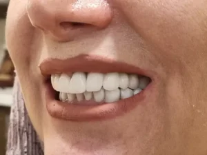 استخدام دستیار دندانپزشک جهت مطب در جردن تهران