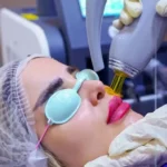 استخدام اپراتور لیزر جهت کلینیک زیبایی معتبر در اسلامشهر
