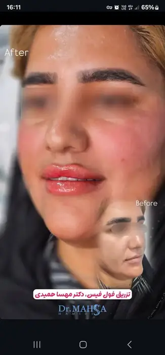 نیازمند منشی باسابقه جهت کلینیک زیبایی دکتر مهسا حمیدی در بندرعباس