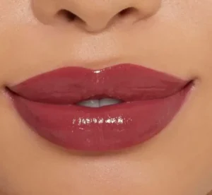 استخدام پزشک متخصص پوست و مو با پروانه جهت مطب در فرمانیه تهران