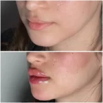 پزشک عمومی هستم مسلط به امور زیبایی مایل به همکاری با کلینیک های زیبایی و درمانی در تهران