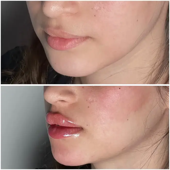 پزشک عمومی هستم مسلط به امور زیبایی مایل به همکاری با کلینیک های زیبایی و درمانی در تهران