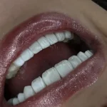 استخدام ادمین جهت تولید محتوا برای پیج کلینیک دندانپزشکی زیبایی در صادقیه تهران