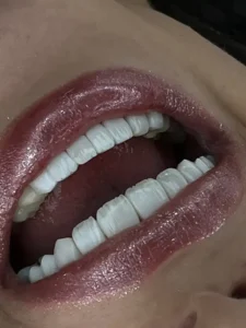 استخدام ادمین جهت تولید محتوا برای پیج کلینیک دندانپزشکی زیبایی در صادقیه تهران