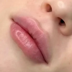 پزشک عمومی هستم آماده همکاری در کلینیک های زیبایی در جم استان بوشهر