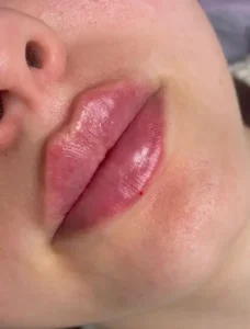استخدام پزشک عمومی مسلط به تمامی لاین های زیبایی جهت کلینیک در کرج