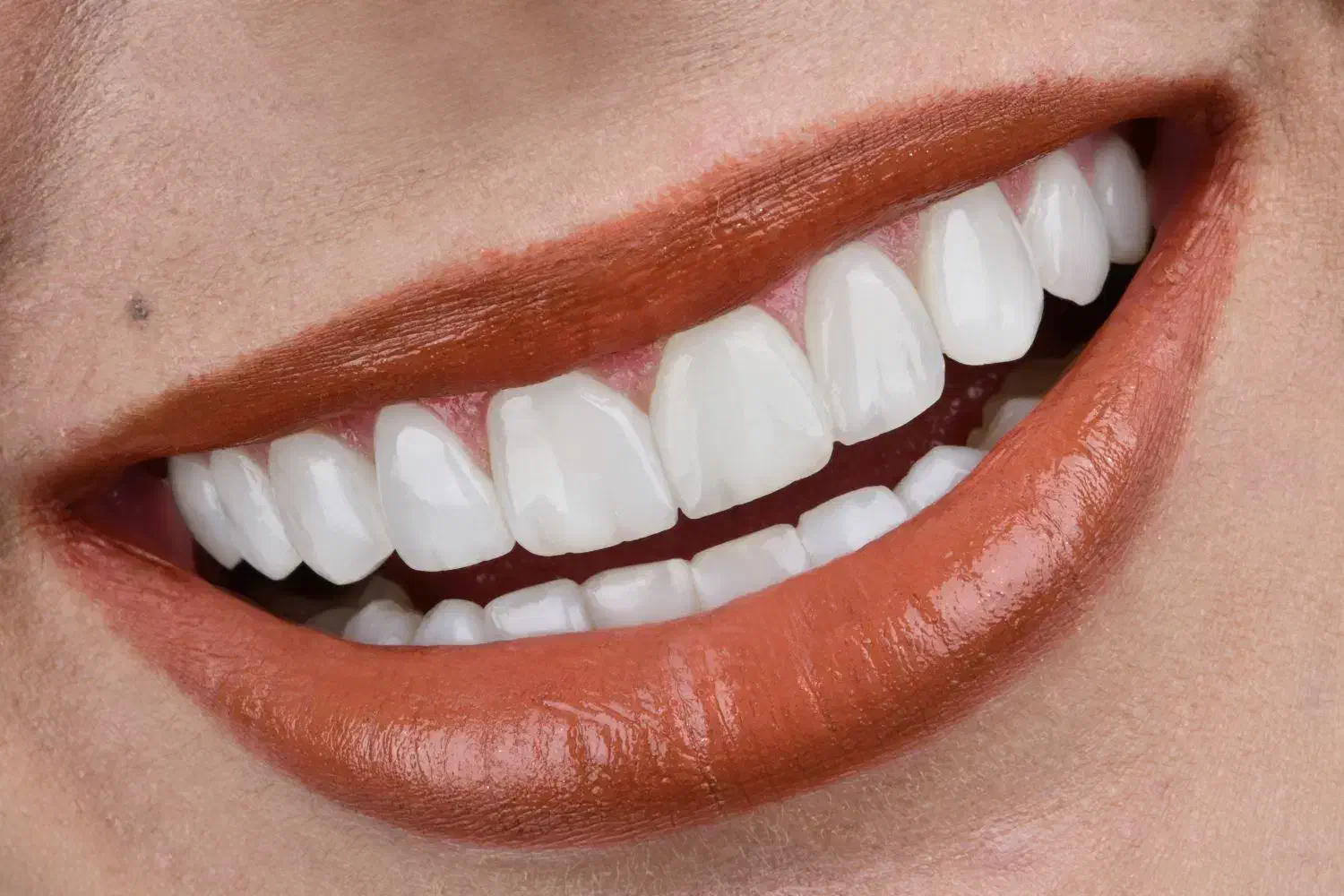 استخدام منشی و دستیار جهت مطب دندانپزشکی در فرمانیه تهران