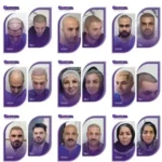 استخدام دستیار خانم جهت کلینیک زیبایی و کاشت مو در تبریز