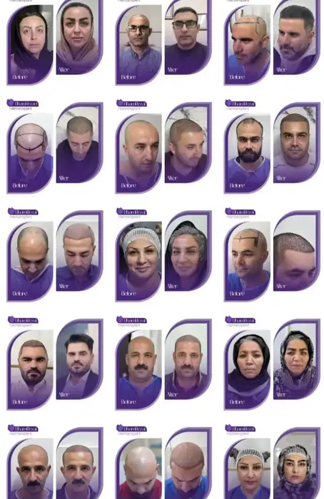 استخدام دستیار خانم جهت کلینیک زیبایی و کاشت مو در تبریز