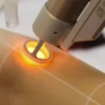 استخدام اپراتور دستگاه لیزر شاتی در اصفهان