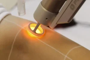 استخدام اپراتور دستگاه لیزر شاتی در اصفهان