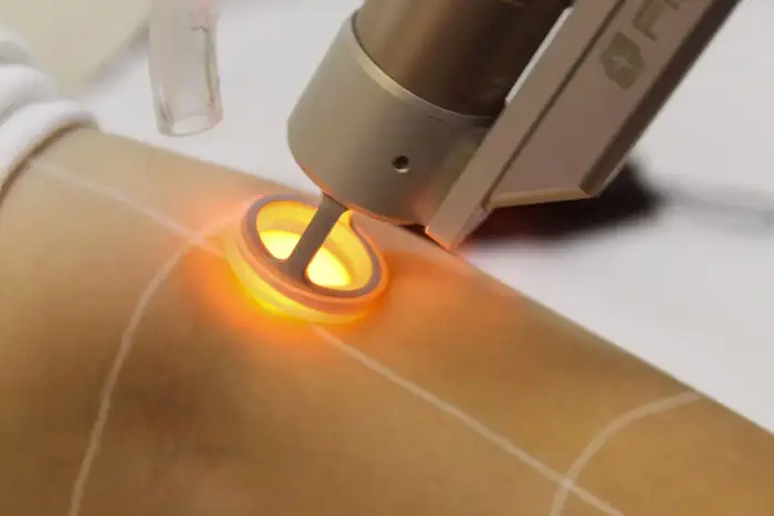 استخدام اپراتور دستگاه لیزر شاتی در اصفهان