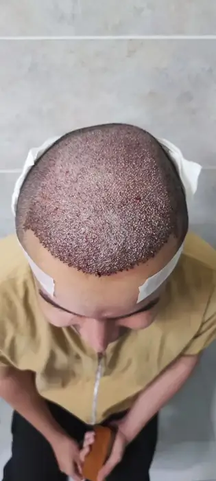 استخدام دستیار کاشت مو جهت کلینیک پوست و مو در کرمانشاه