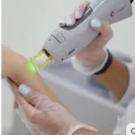 نیازمند اپراتور لیزر با دستگاه جهت مطب زیر نظر پزشک در زنجان