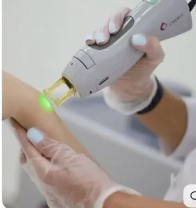 نیازمند اپراتور لیزر با دستگاه جهت مطب زیر نظر پزشک در زنجان