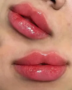 نیازمند تکنسین تزریق فیلر و بوتاکس جهت کلینیک زیبایی زیر نظر پزشک در پادادشهر اهواز