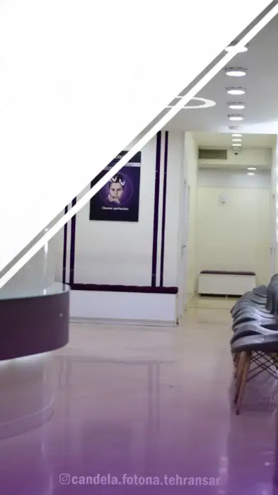 استخدام اپراتور لیزر کندلا در تهرانسر تهران