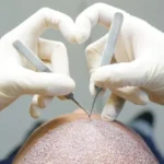 نیازمند دستیار کاشت مو جهت کلینیک در تبریز