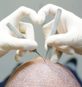 نیازمند دستیار کاشت مو جهت کلینیک در تبریز