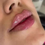 نیازمند پزشک آشنا به تزریق ژل و بوتاکس جهت کلینیک زیبایی در یاسوج