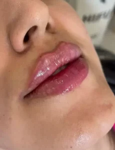 نیازمند پزشک آشنا به تزریق ژل و بوتاکس جهت کلینیک زیبایی در یاسوج