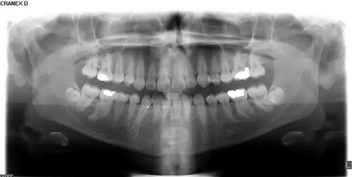 استخدام مسئول پذیرش و دستیار جهت درمانگاه دندانپزشکی در فردیس کرج