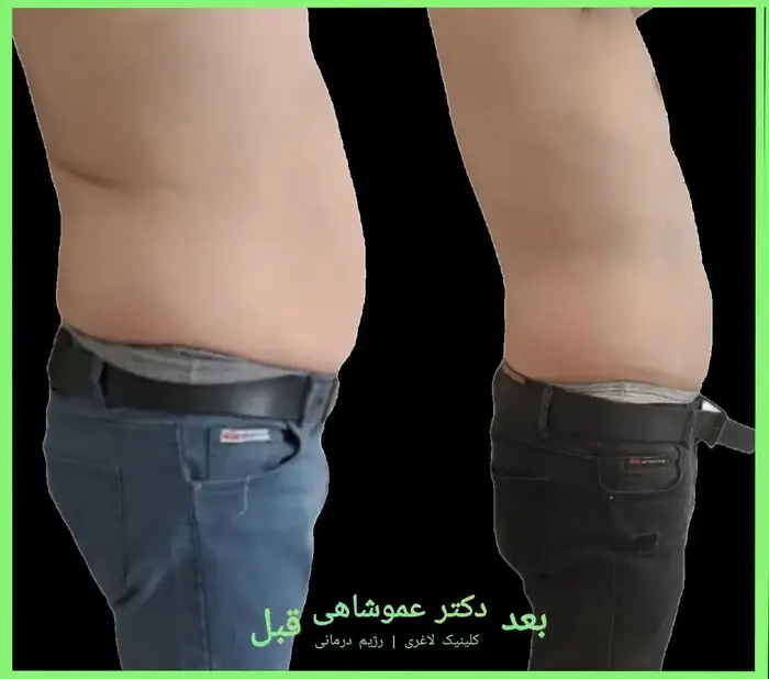 استخدام و آموزش اپراتور دستگاههای لاغری در اصفهان