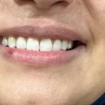 نیازمند منشی جهت لابراتوار دندانسازی در ونک تهران