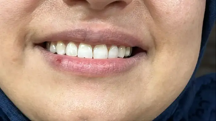 نیازمند منشی جهت لابراتوار دندانسازی در ونک تهران